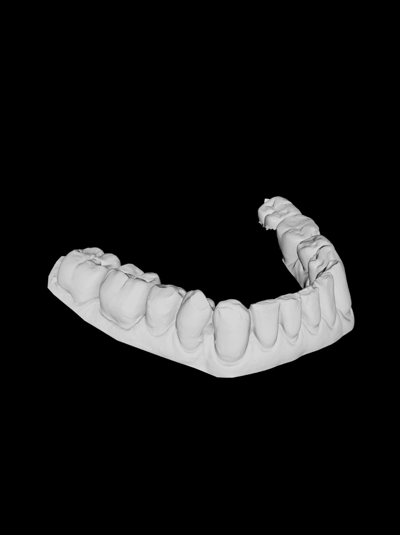 Ponte in zirconia mostrato come STL 3D grezzo