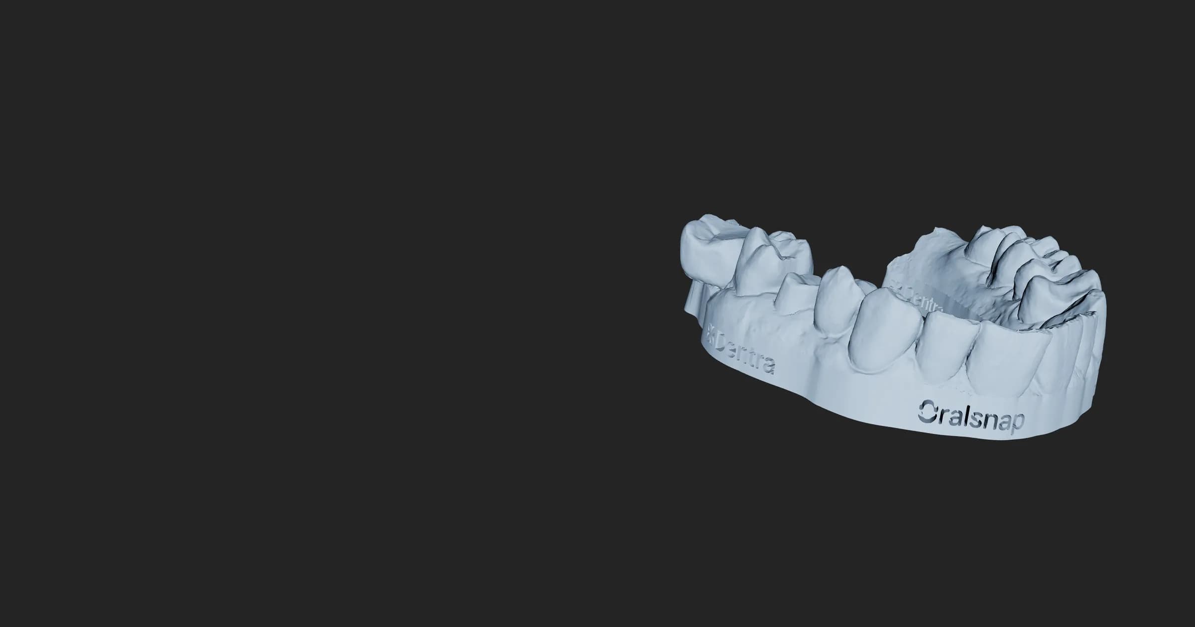 Ein dentales Modell mit Sockel und gravierten Logos, gerade in Oralsnap Model aus einem Intraoralscan erstellt