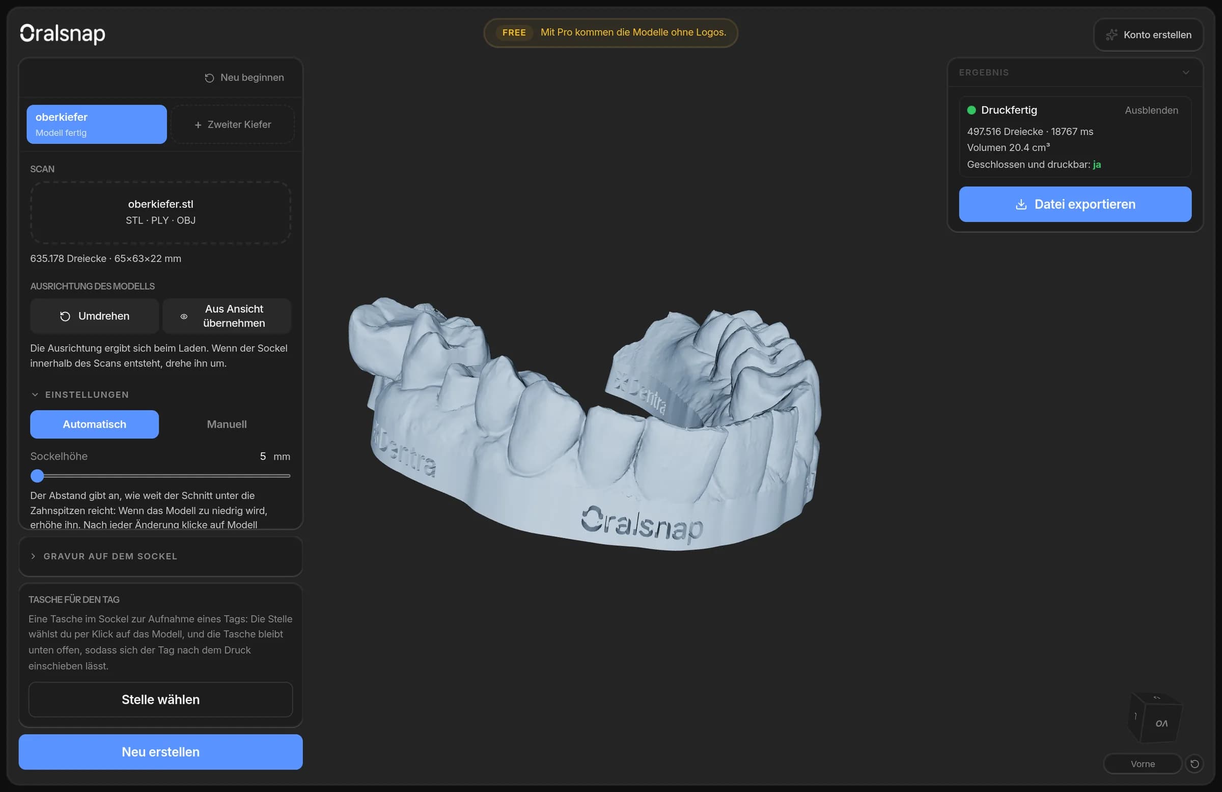 Oralsnap Model im Browser: der geladene Scan, links die Einstellungen und das druckfertige Modell