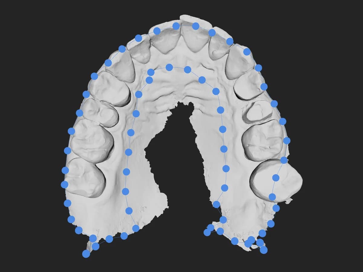 Ein von Hand entlang der Gingiva gezeichneter Rand auf einem Scan, in Oralsnap Model