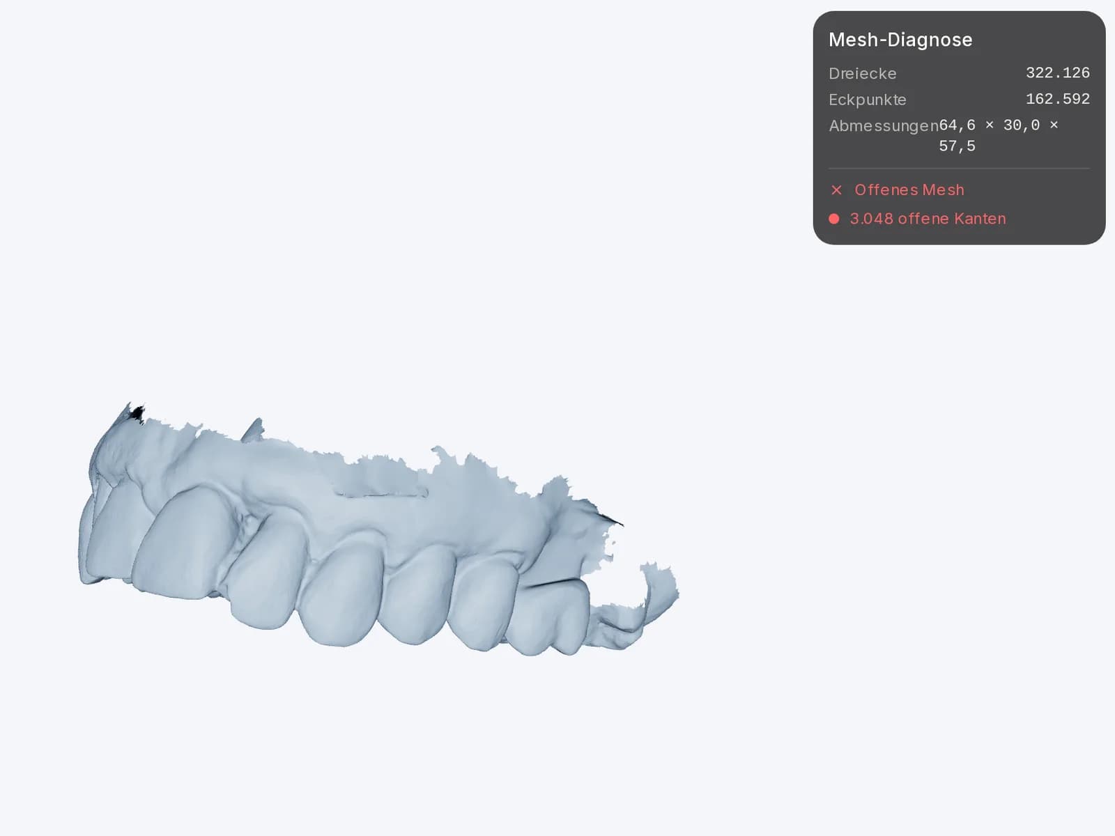 Die geöffnete Mesh-Diagnose in Dentra Viewer, mit Dreiecken, Eckpunkten und Abmessungen