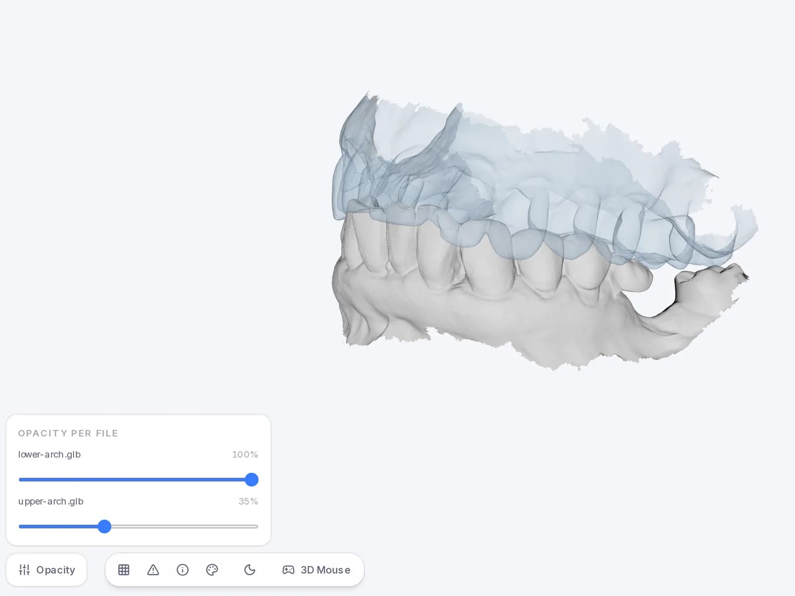 The two arches in Dentra Viewer, with the upper arch made transparent